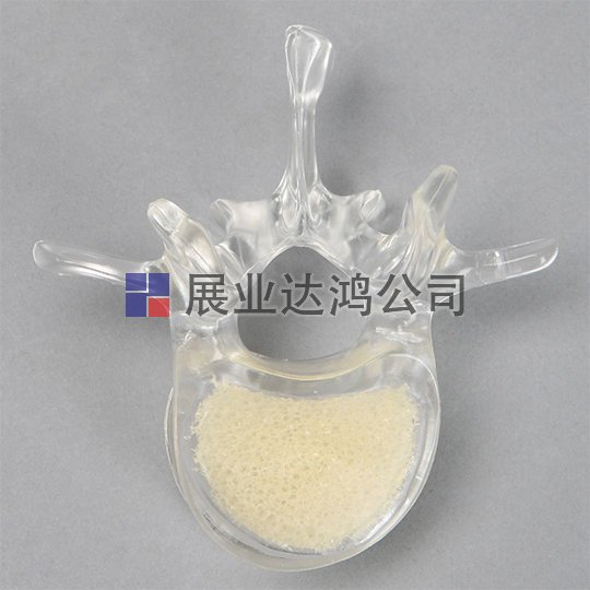 SAWBONES L1～L5椎骨解剖透明模型